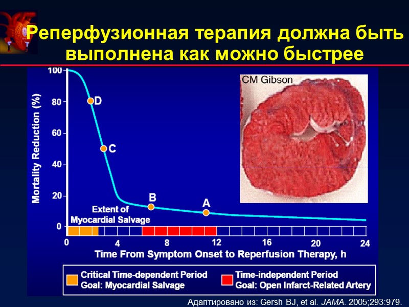 Реперфузионная терапия должна быть выполнена как можно быстрее Адаптировано из: Gersh BJ, et al. Реперфузионная терапия должна быть выполнена как можно быстрее Адаптировано из: Gersh BJ, et al.